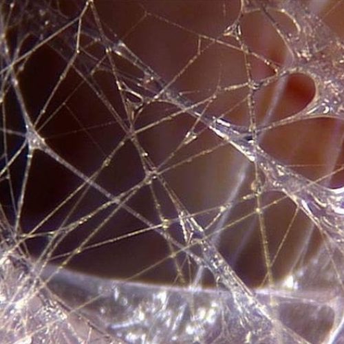 image strier d'un fascia
